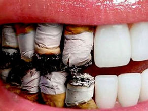 ¿Cómo influye el tabaco en la cavidad oral?