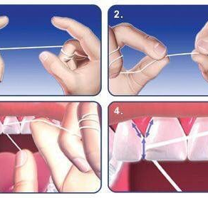 Hilo dental? Para qué sirve?