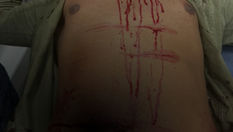 Gang Clash in Mulund: Violent Fight Leaves Several Injured, Tension Grips Area