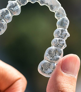 invisalign-aparelho-invisivel-2048x1024.jpg