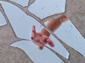 I Have Body Dysmorphia