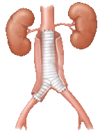 Frederico Linhares - Cirurgia vascular - Angiologista- Fortaleza