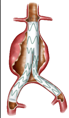 Frederico Linhares - Cirurgia vascular - Angiologista- Fortaleza
