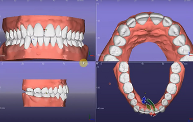 ortho sim.PNG