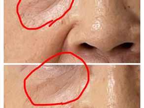 身体が楽になってきたら、お顔が気になりだして…