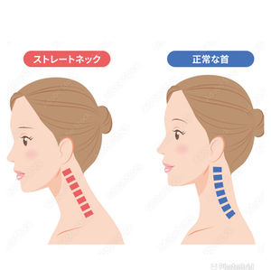 スマホ首さん！体調不良のほかにボディラインに影響でてるかもですよ