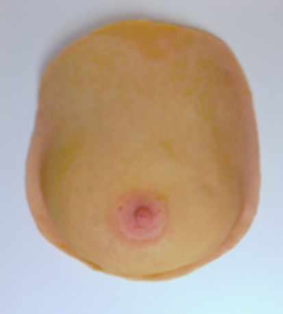 Breast Model