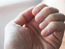 Cómo tus uñas te advierten sobre tu salud y ayudan a detectar enfermedades