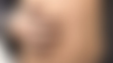 Avanza Sarampión en el país durante 2026