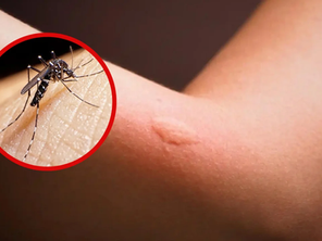Más lluvias, más riesgo de dengue; toma medidas preventivas