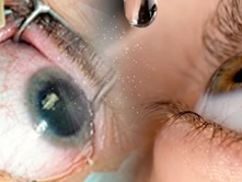 Desarrolla UNAM nueva alternativa contra la retinopatía diabética