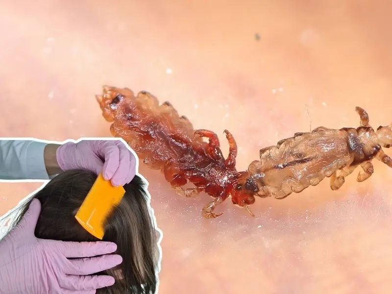 ree