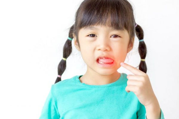 ¿Por qué tarda menos en curarse una herida en la boca?