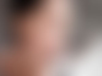 Tu rostro puede ser un mapa de tu salud: 9 señales de enfermedad en la cara