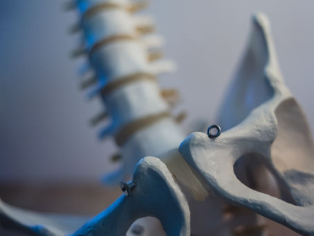 08. Anterior pelvic tilt. Beware ?