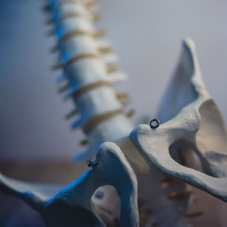 08. Anterior pelvic tilt. Beware ?