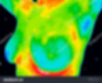 stock-photo-thermographic-image-of-a-chest-showing-different-temperatures-from-blue-showing-cold-to-