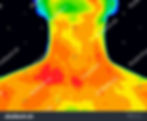 stock-photo-thermographic-photo-of-human-neck-showing-temperatures-in-range-of-colors-from-blue-cold