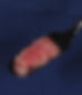 Bone implant and PRF mix
