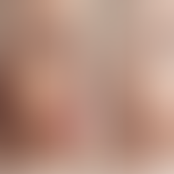 before and after photo of a blonde woman smiling