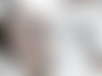 Waarom kiezen voor De Gezichtskliniek in Utrecht voor lip fillers?