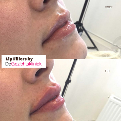 Copy of 0.5ml 26.08.png