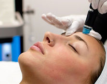 Microneedling Brazilian MedSpa Liverpool