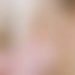 Achieve Natural, Youthful Radiance: Guide to Expert Filler & Botox in Plano, Texas
