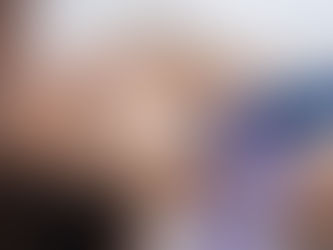 MIcroneedling img 1
