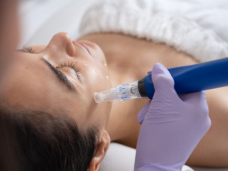 MIcroneedling img 1