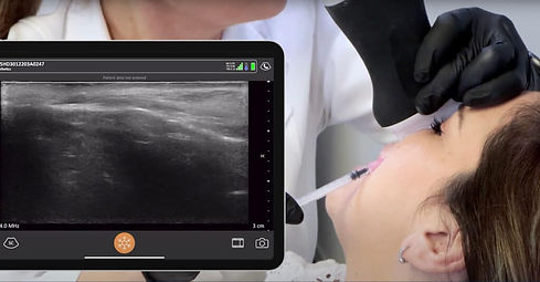 ecografia-facial-clarius-L20-2023-1024x535.jpg