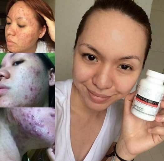 ad_image_5897086_1487630873