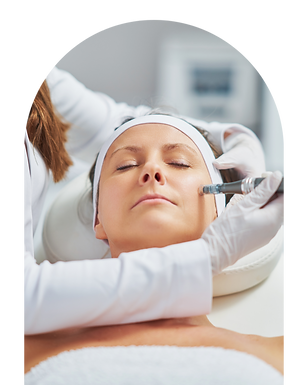 Microneedling Colorado Springs