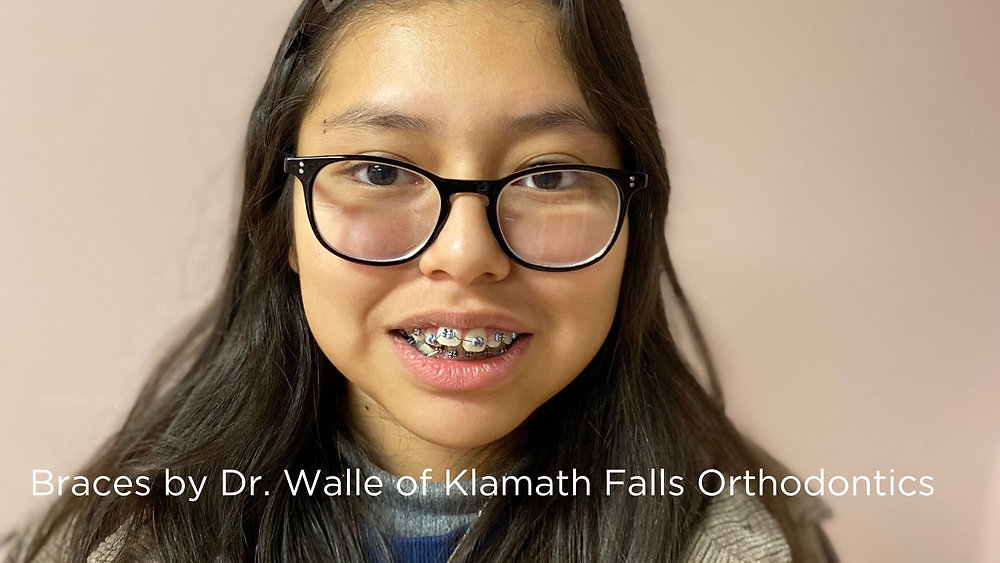 New Oregon Medicaid Orthodontic Benefit Effective 1/1/2023