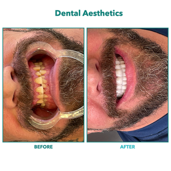 Dental Aesthetics.005.png