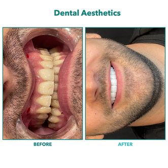 Dental Aesthetics.004.png
