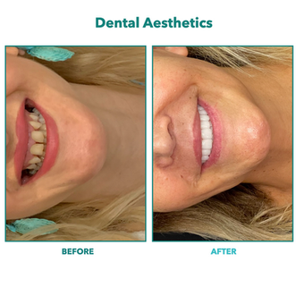 Before-After dental.003.png