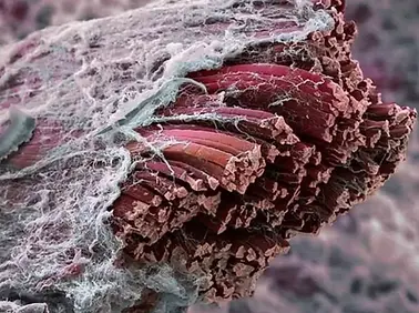 10-truths-about-fascia-1200xauto.webp