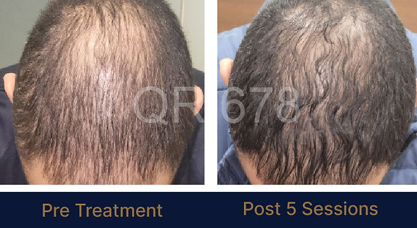 QR678_WEBSITE_BEFORE AFTER (1).jpg