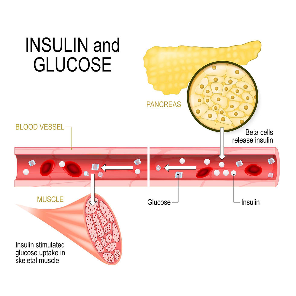 Is Diabetes Really About Sugar?