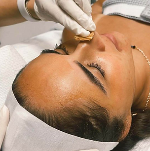 Chemical peel.png