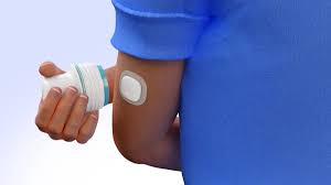 Medtronic Simplera CGM image