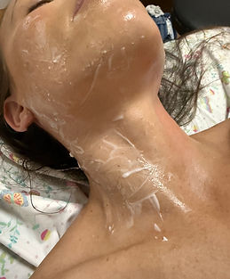 Before-Neck (1).jpg