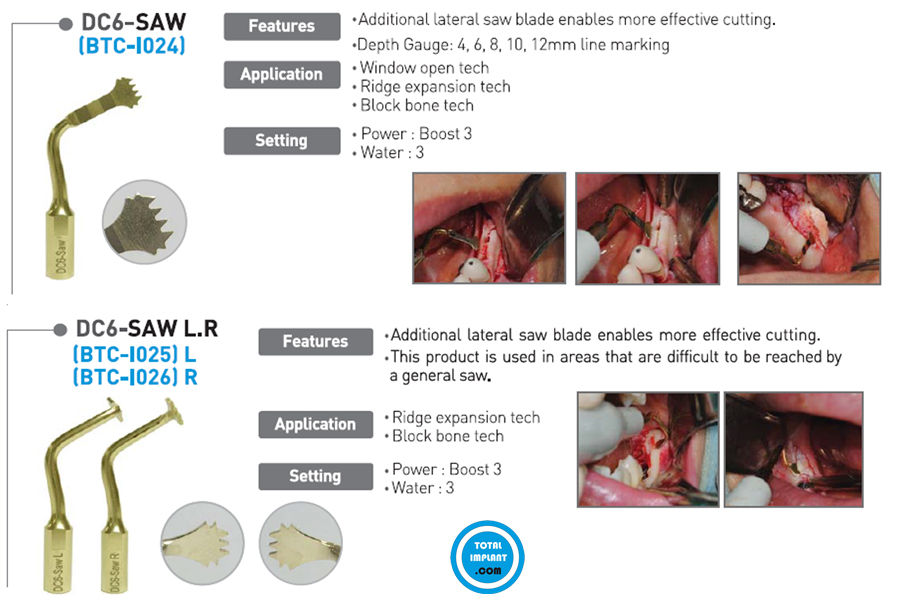 Thumbnail: Dental Piezosurgery Bone Graft Ultrasonic Machine