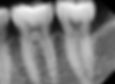 Dental Xray Sensor Size 2