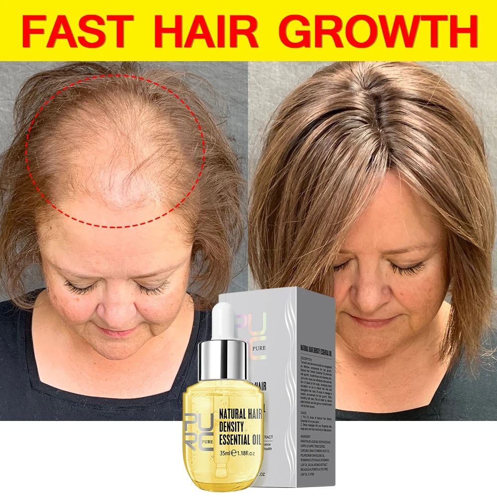 Fast Hair Growth for Men Women Hair Oil Care Ginger Anti Hair Loss Scalp