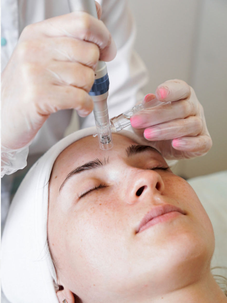 Microneeding Nutrition Dermapen Jacksonville