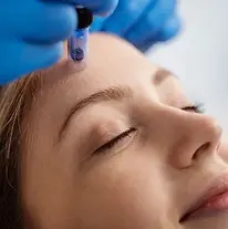 a women getting microneedling with PRP/PRF