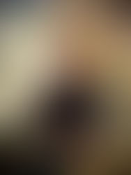 Anatomy and Biomechanics Related to Saddlery