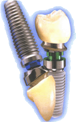 100% personalizável